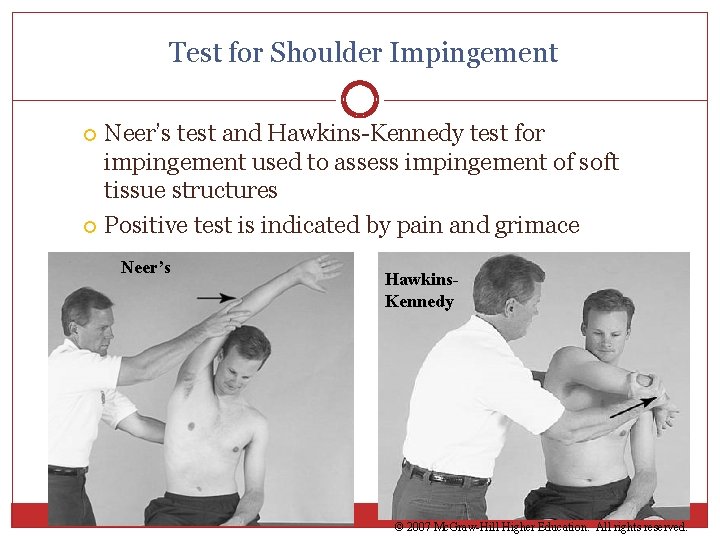 Test for Shoulder Impingement Neer’s test and Hawkins-Kennedy test for impingement used to assess