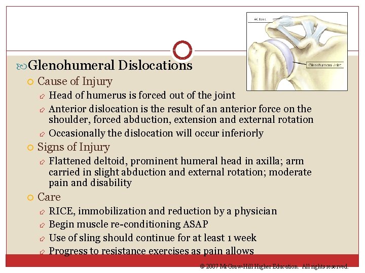  Glenohumeral Dislocations Cause of Injury Head of humerus is forced out of the