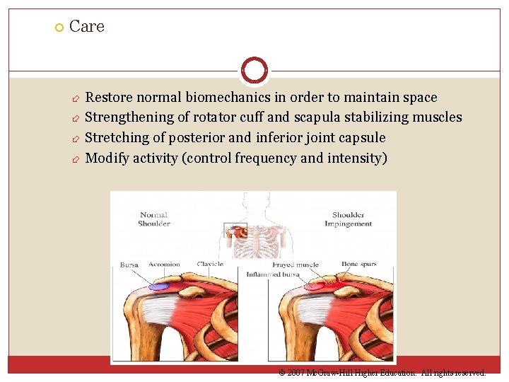  Care Restore normal biomechanics in order to maintain space Strengthening of rotator cuff