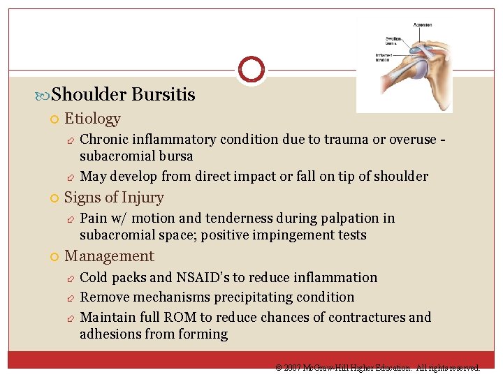 Shoulder Bursitis Etiology Chronic inflammatory condition due to trauma or overuse subacromial bursa