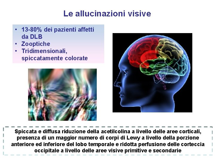 Le allucinazioni visive • 13 -80% dei pazienti affetti da DLB • Zooptiche • Le allucinazioni visive • 13 -80% dei pazienti affetti da DLB • Zooptiche •