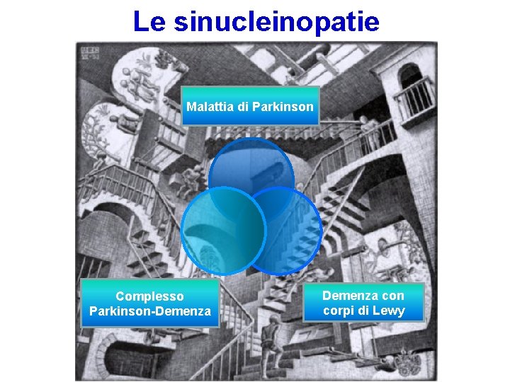 Le sinucleinopatie Malattia di Parkinson Complesso Parkinson-Demenza con corpi di Lewy Le sinucleinopatie Malattia di Parkinson Complesso Parkinson-Demenza con corpi di Lewy