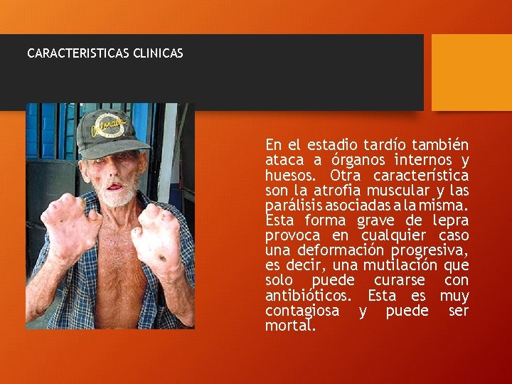 CARACTERISTICAS CLINICAS En el estadio tardío también ataca a órganos internos y huesos. Otra