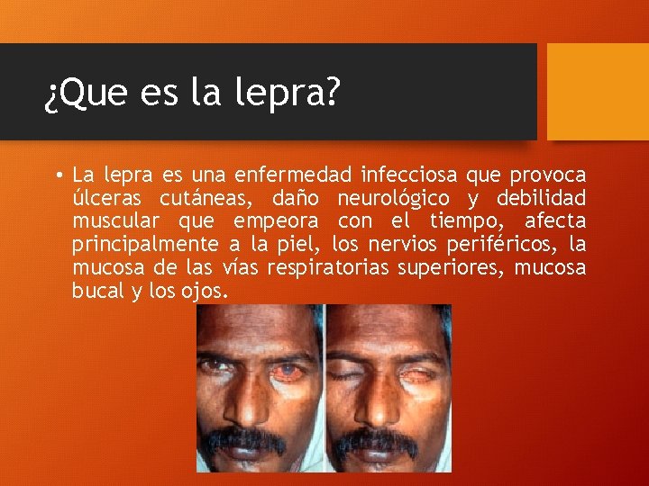 ¿Que es la lepra? • La lepra es una enfermedad infecciosa que provoca úlceras