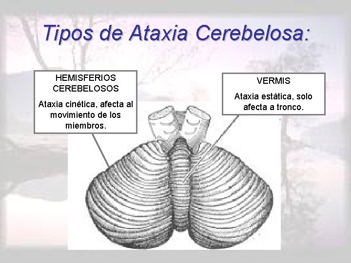 Tipos de Ataxia Cerebelosa: HEMISFERIOS CEREBELOSOS Ataxia cinética, afecta al movimiento de los miembros.