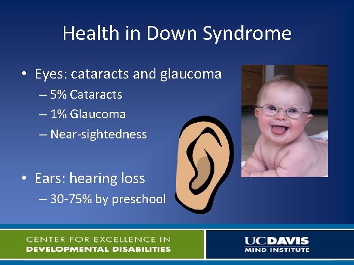 Health in Down Syndrome • Eyes: cataracts and glaucoma – 5% Cataracts – 1%