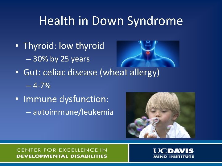 Health in Down Syndrome • Thyroid: low thyroid – 30% by 25 years •