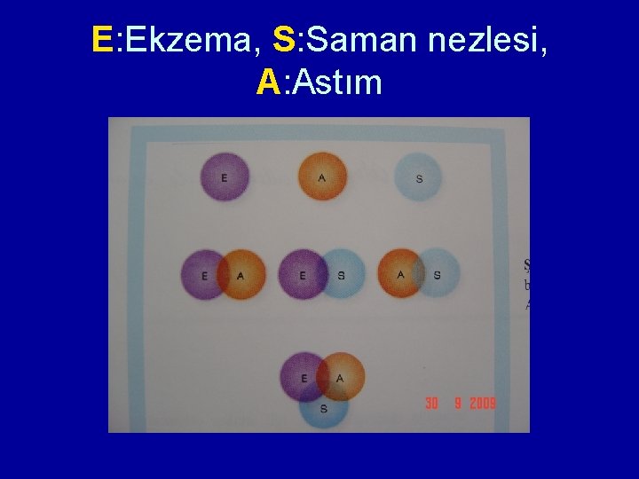 E: Ekzema, S: Saman nezlesi, A: Astım E: Ekzema, S: Saman nezlesi, A: Astım