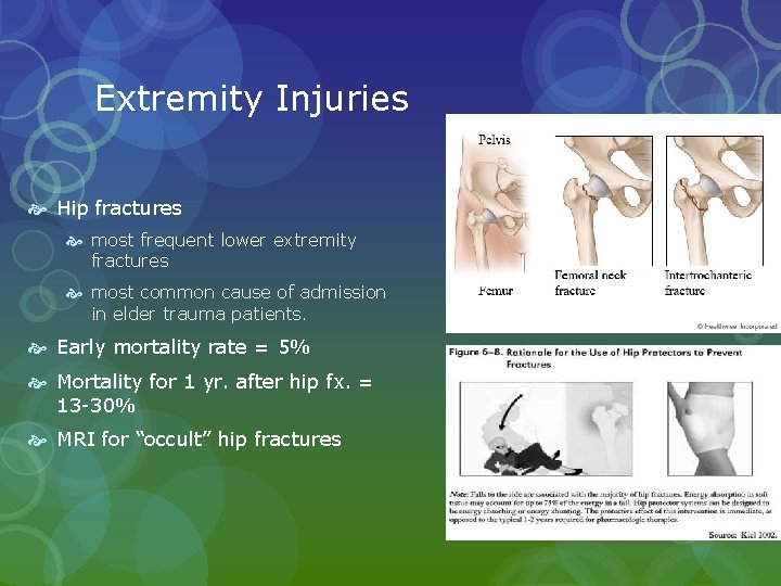 Extremity Injuries Hip fractures most frequent lower extremity fractures most common cause of admission Extremity Injuries Hip fractures most frequent lower extremity fractures most common cause of admission