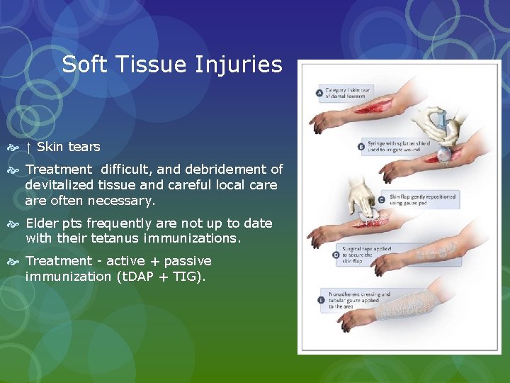 Soft Tissue Injuries ↑ Skin tears Treatment difficult, and debridement of devitalized tissue and Soft Tissue Injuries ↑ Skin tears Treatment difficult, and debridement of devitalized tissue and