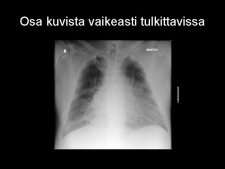 Osa kuvista vaikeasti tulkittavissa 