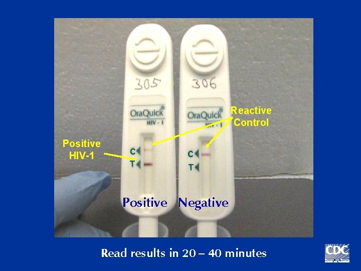 Reactive Control Positive HIV-1 C C T T Positive Negative Read results in 20