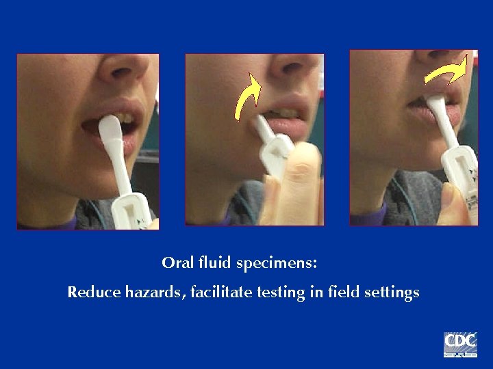 Oral fluid specimens: Reduce hazards, facilitate testing in field settings 