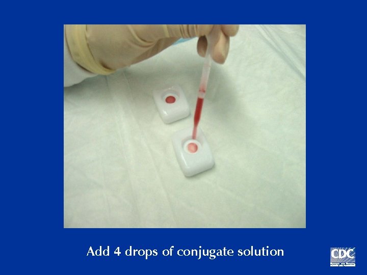 Add 4 drops of conjugate solution 