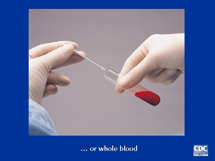 … or whole blood 