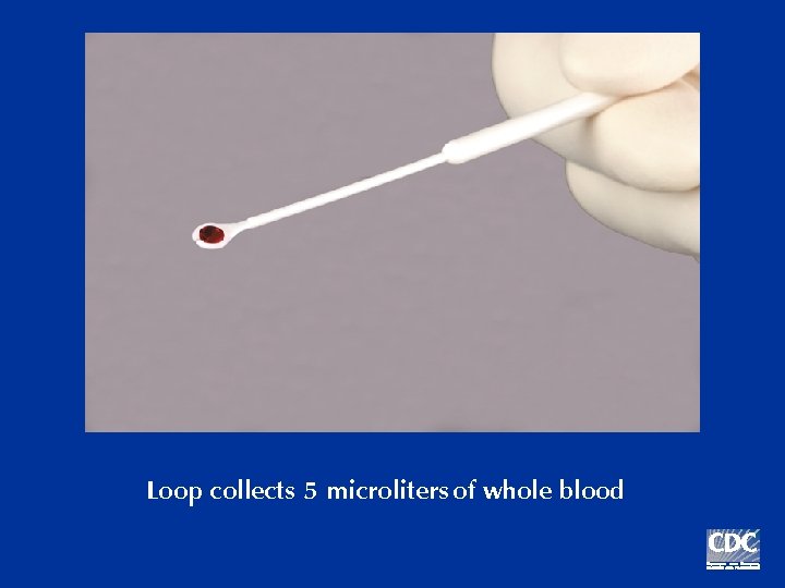 Loop collects 5 microliters of whole blood 