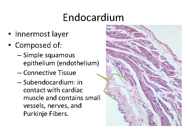 Endocardium • Innermost layer • Composed of: – Simple squamous epithelium (endothelium) – Connective
