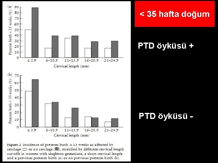 < 35 hafta doğum PTD öyküsü + PTD öyküsü - 