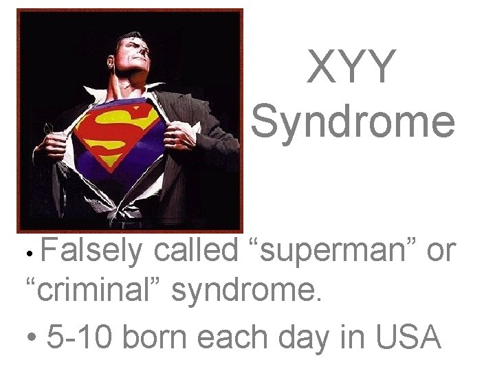 XYY Syndrome • Falsely called “superman” or “criminal” syndrome. • 5 -10 born each