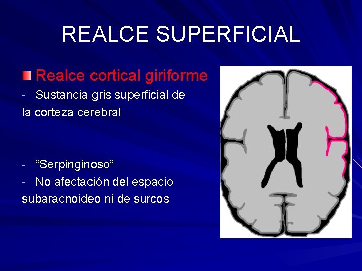 REALCE SUPERFICIAL Realce cortical giriforme - Sustancia gris superficial de la corteza cerebral -