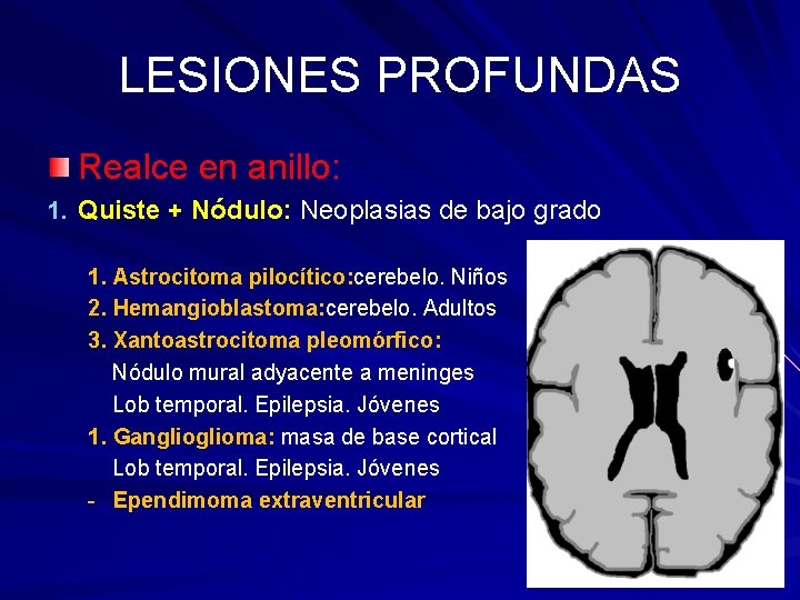 LESIONES PROFUNDAS Realce en anillo: 1. Quiste + Nódulo: Neoplasias de bajo grado 1.