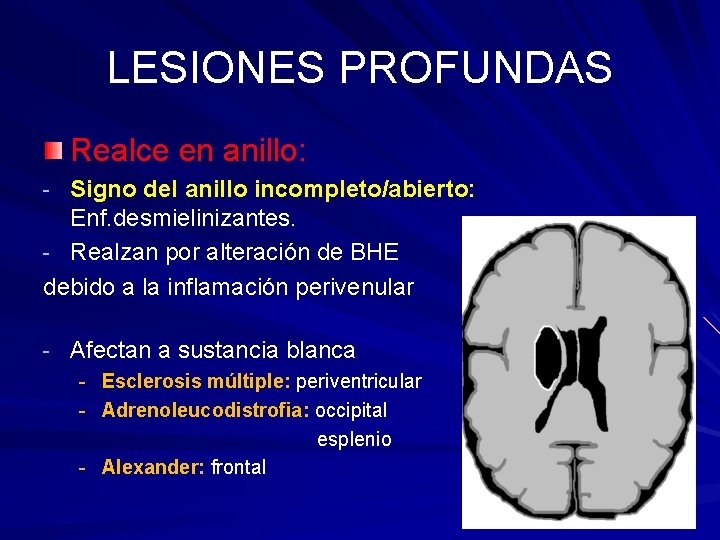 LESIONES PROFUNDAS Realce en anillo: - Signo del anillo incompleto/abierto: Enf. desmielinizantes. - Realzan