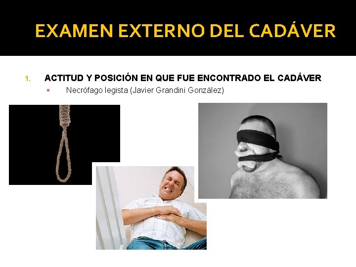 EXAMEN EXTERNO DEL CADÁVER 1. ACTITUD Y POSICIÓN EN QUE FUE ENCONTRADO EL CADÁVER EXAMEN EXTERNO DEL CADÁVER 1. ACTITUD Y POSICIÓN EN QUE FUE ENCONTRADO EL CADÁVER