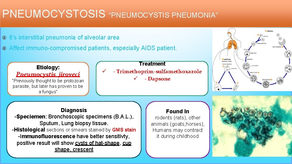 PNEUMOCYSTOSIS “PNEUMOCYSTIS PNEUMONIA” It’s interstitial pneumonia of alveolar area Affect immuno-compromised patients, especially AIDS