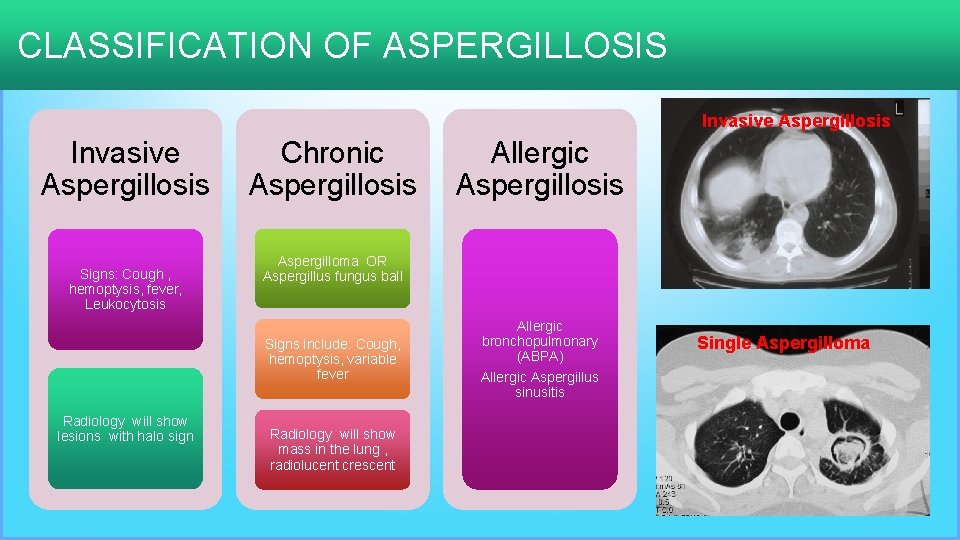 CLASSIFICATION OF ASPERGILLOSIS Invasive Aspergillosis Signs: Cough , hemoptysis, fever, Leukocytosis Chronic Aspergillosis Aspergilloma