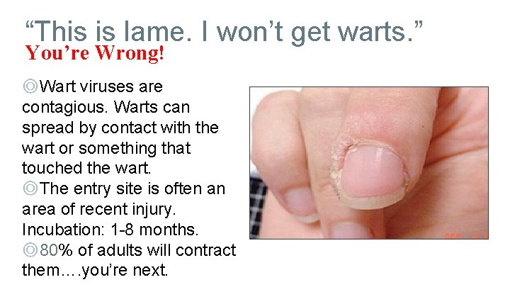 “This is lame. I won’t get warts. ” You’re Wrong! ◎Wart viruses are contagious.