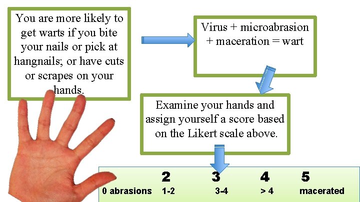 You are more likely to get warts if you bite your nails or pick