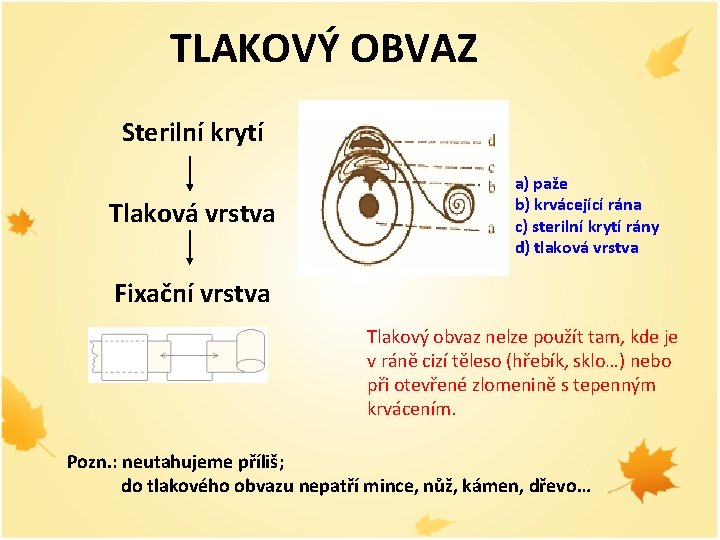 TLAKOVÝ OBVAZ Sterilní krytí Tlaková vrstva a) paže b) krvácející rána c) sterilní krytí