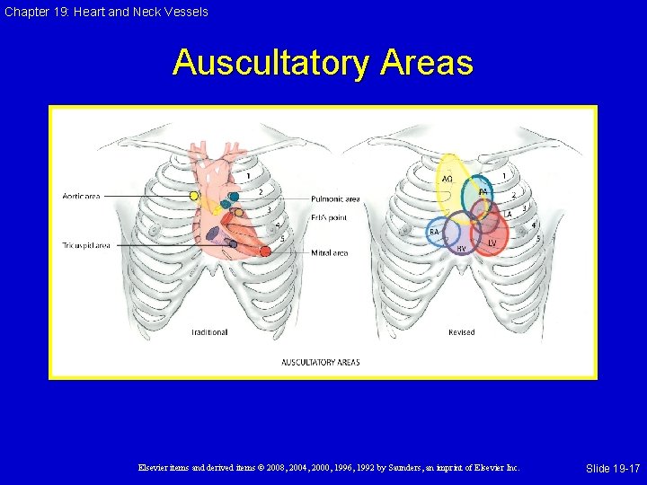 Chapter 19: Heart and Neck Vessels Auscultatory Areas Elsevier items and derived items © Chapter 19: Heart and Neck Vessels Auscultatory Areas Elsevier items and derived items ©