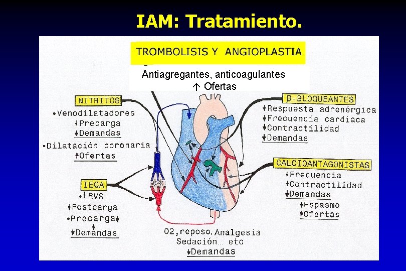 IAM: Tratamiento. Antiagregantes, anticoagulantes Ofertas 