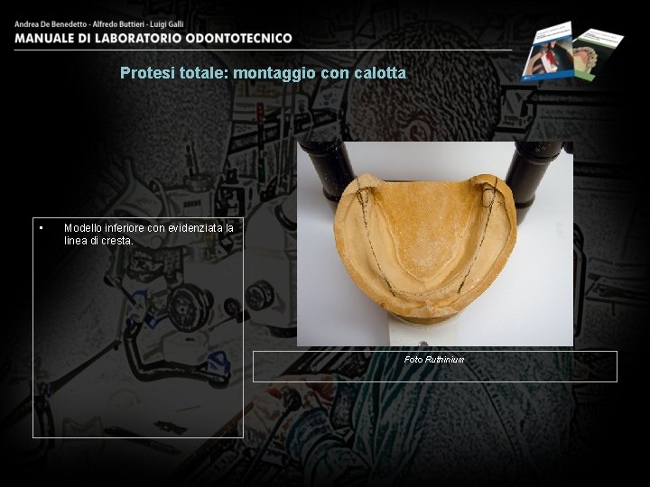 Protesi totale: montaggio con calotta • Modello inferiore con evidenziata la linea di cresta.