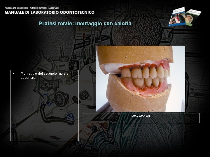 Protesi totale: montaggio con calotta • Montaggio del secondo molare superiore. Foto Ruthinium 11