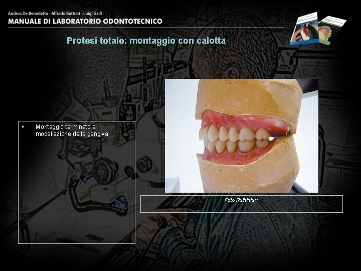 Protesi totale: montaggio con calotta • Montaggio terminato e modellazione della gengiva. Foto Ruthinium