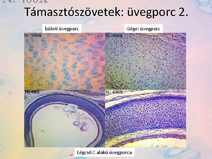 Támasztószövetek: üvegporc 2. Ízületi üvegporc Gége: üvegporc Légcső C alakú üvegporca 