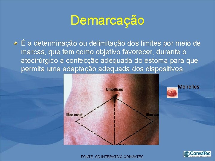 Demarcação É a determinação ou delimitação dos limites por meio de marcas, que tem