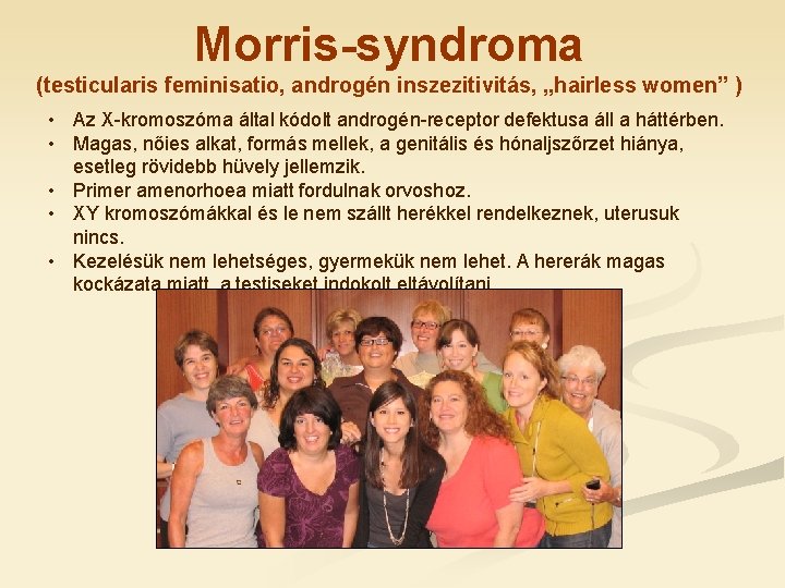 Morris-syndroma (testicularis feminisatio, androgén inszezitivitás, „hairless women” ) • Az X-kromoszóma által kódolt androgén-receptor