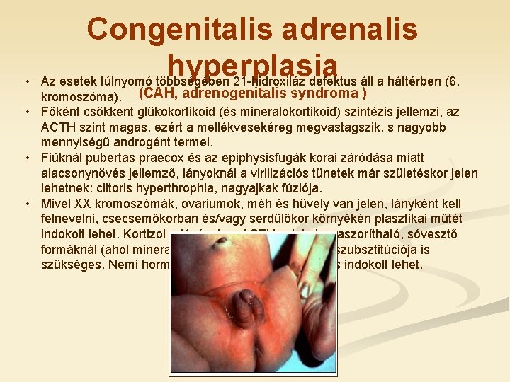  • Congenitalis adrenalis hyperplasia Az esetek túlnyomó többségében 21 -hidroxiláz defektus áll a