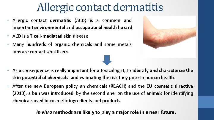 Allergic contact dermatitis • Allergic contact dermatitis (ACD) is a common and important environmental