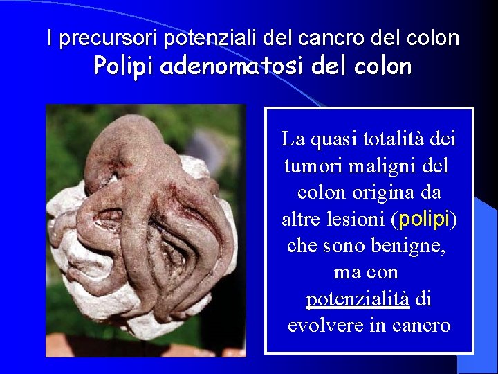 I precursori potenziali del cancro del colon Polipi adenomatosi del colon La quasi totalità