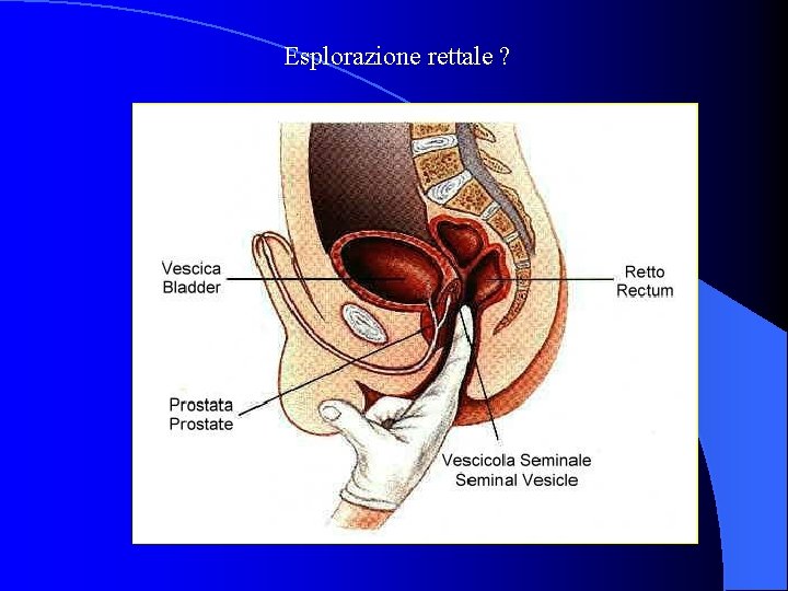 Esplorazione rettale ? 