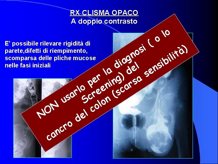 RX CLISMA OPACO A doppio contrasto lo o ( i ) s à o