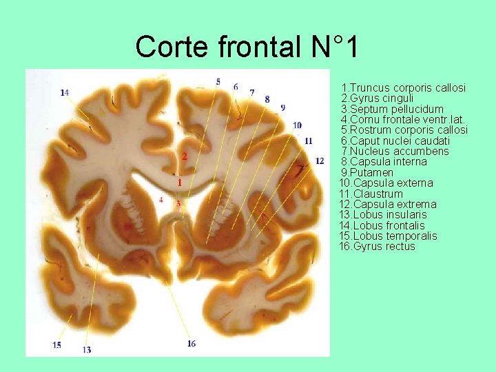 Corte frontal N° 1 • 1. Truncus corporis callosi 2. Gyrus cinguli 3. Septum