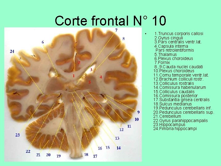 Corte frontal N° 10 • 1. Truncus corporis callosi 2. Gyrus cinguli 3. Pars