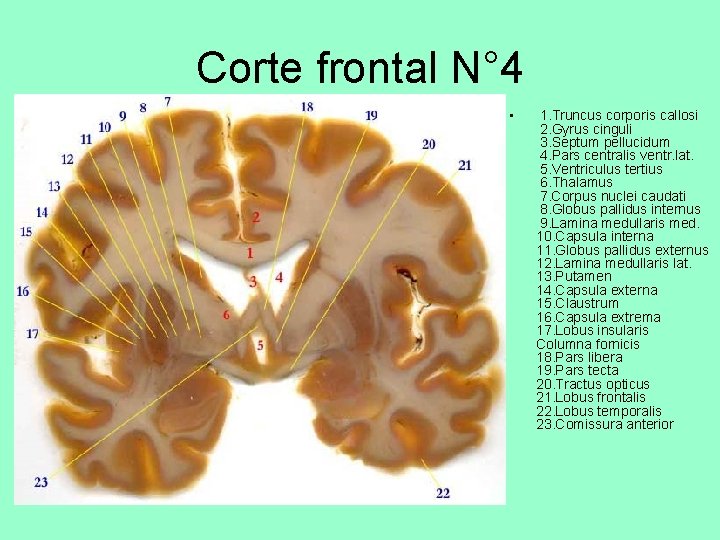 Corte frontal N° 4 • 1. Truncus corporis callosi 2. Gyrus cinguli 3. Septum