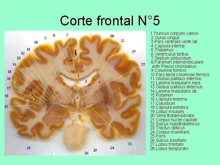 Corte frontal N° 5 • 1. Truncus corporis callosi 2. Gyrus cinguli 3. Pars