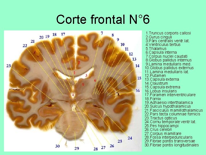 Corte frontal N° 6 • 1. Truncus corporis callosi 2. Gyrus cinguli 3. Pars